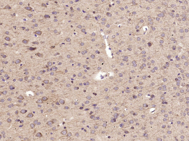 ABCG1 Antibody in Immunohistochemistry (Paraffin) (IHC (P))