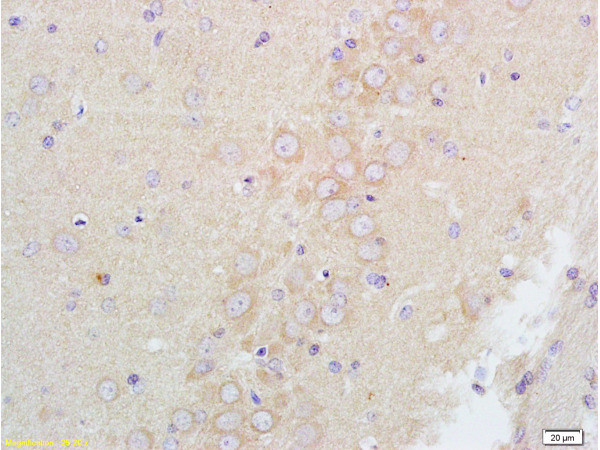 GABA A Receptor alpha 1 Antibody in Immunohistochemistry (Paraffin) (IHC (P))