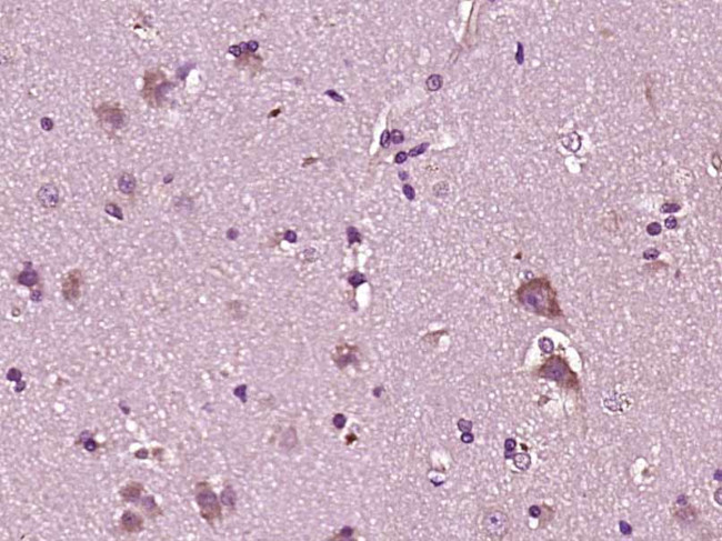 YKL39/CHI3L2 Antibody in Immunohistochemistry (Paraffin) (IHC (P))