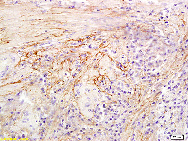 Hyaluronidase-1 Antibody in Immunohistochemistry (Paraffin) (IHC (P))