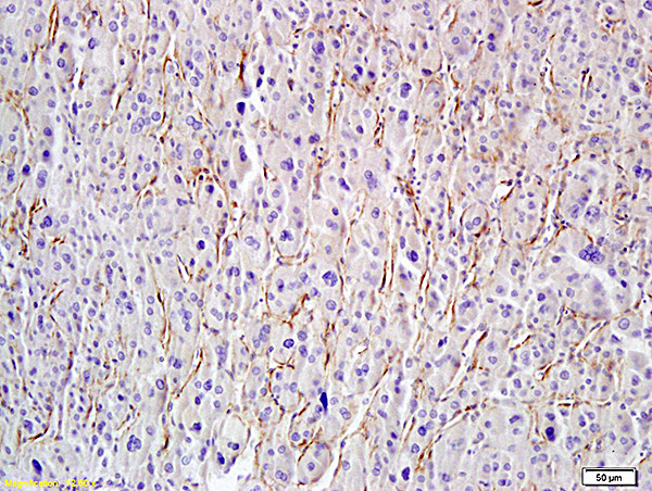 Hyaluronidase-1 Antibody in Immunohistochemistry (Paraffin) (IHC (P))