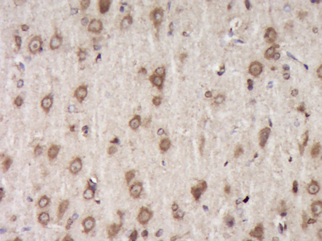 Fibromodulin Antibody in Immunohistochemistry (Paraffin) (IHC (P))