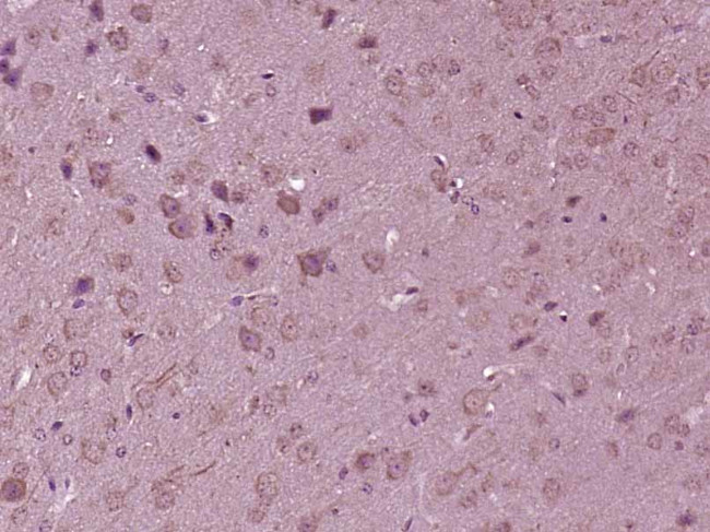 K7 Antibody in Immunohistochemistry (Paraffin) (IHC (P))