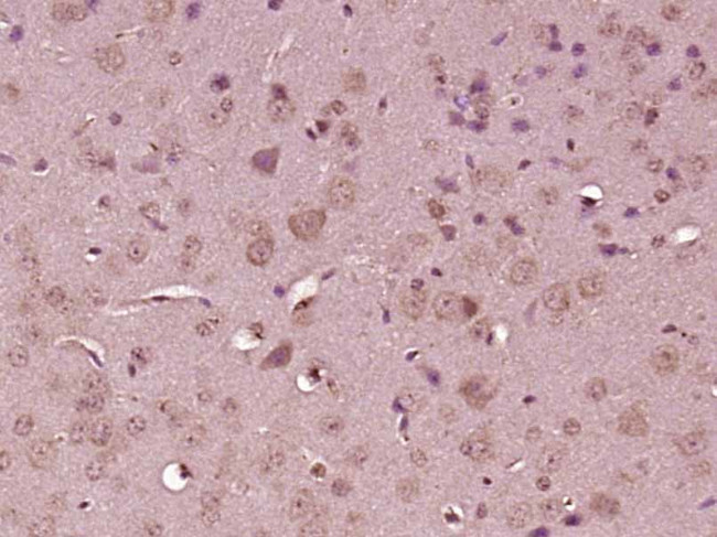 MAPK6/ERK3 Antibody in Immunohistochemistry (Paraffin) (IHC (P))