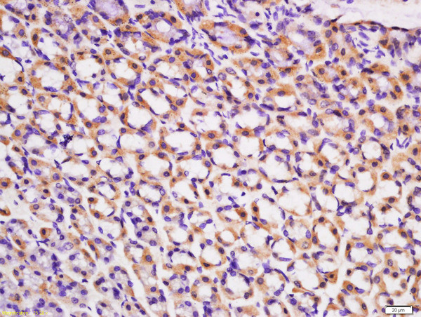 ACVR2B/ACTR2B Antibody in Immunohistochemistry (Paraffin) (IHC (P))