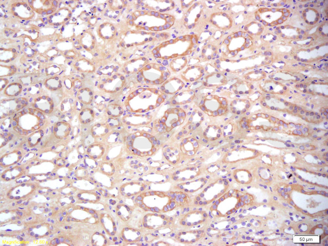 BAMBI Antibody in Immunohistochemistry (Paraffin) (IHC (P))