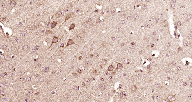 14-3-3 beta Antibody in Immunohistochemistry (Paraffin) (IHC (P))