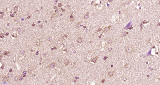 14-3-3 beta Antibody in Immunohistochemistry (Paraffin) (IHC (P))