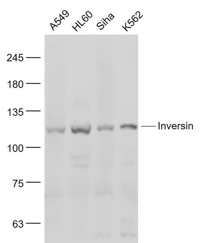 Inversin Antibody in Western Blot (WB)