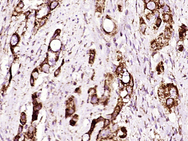 Phospho-ADAM17 (Thr735) Antibody in Immunohistochemistry (Paraffin) (IHC (P))