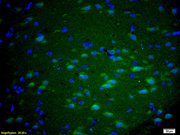 mGluR5 Antibody in Immunohistochemistry (Paraffin) (IHC (P))