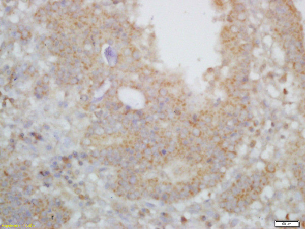 ARPC2/p34-ARC Antibody in Immunohistochemistry (Paraffin) (IHC (P))