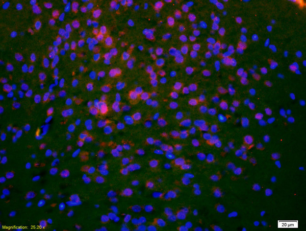 DCLREC1C/Artemis Antibody in Immunohistochemistry (Paraffin) (IHC (P))