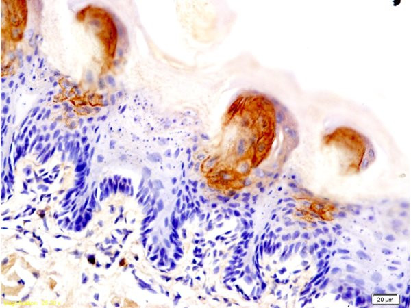 AQP3 Antibody in Immunohistochemistry (Paraffin) (IHC (P))