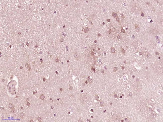 B7-H6 Antibody in Immunohistochemistry (Paraffin) (IHC (P))