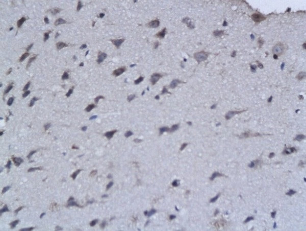 FGF3 Antibody in Immunohistochemistry (Paraffin) (IHC (P))