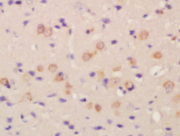 FLRT2 Antibody in Immunohistochemistry (Paraffin) (IHC (P))