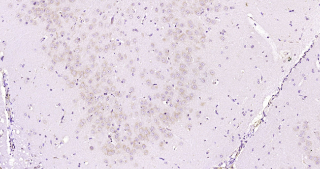 ABH1/ALKB Antibody in Immunohistochemistry (Paraffin) (IHC (P))