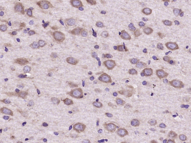 FGF5 Antibody in Immunohistochemistry (Paraffin) (IHC (P))