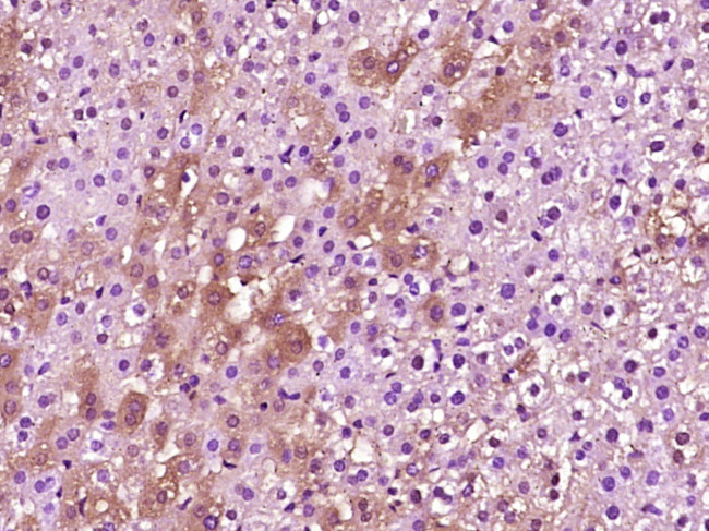 PEX14 Antibody in Immunohistochemistry (Paraffin) (IHC (P))