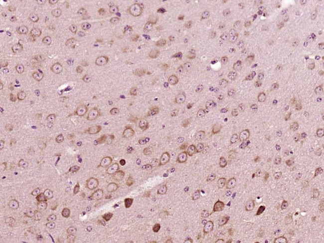 PEX5 Antibody in Immunohistochemistry (Paraffin) (IHC (P))