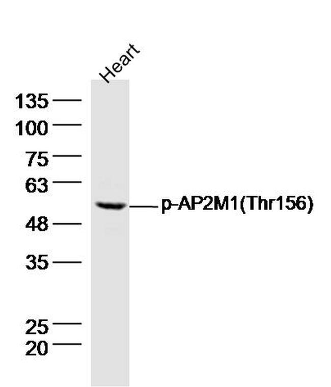 SMYD1 Antibody in Western Blot (WB)