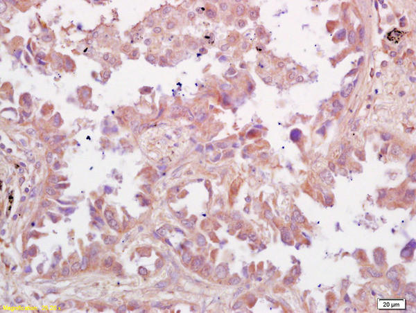 RSV Antibody in Immunohistochemistry (Paraffin) (IHC (P))