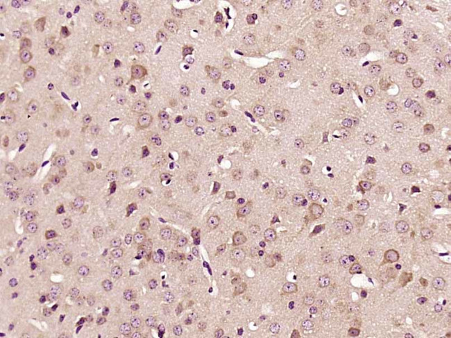 PKC iota Antibody in Immunohistochemistry (Paraffin) (IHC (P))