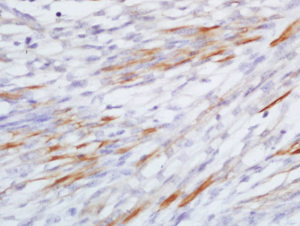 CCL20/MIP3 alpha Antibody in Immunohistochemistry (Paraffin) (IHC (P))