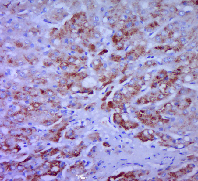 CCL20/MIP3 alpha Antibody in Immunohistochemistry (Paraffin) (IHC (P))