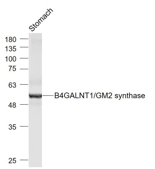B4GALNT1/GM2 synthase Antibody in Western Blot (WB)