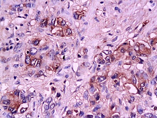 E-Selectin/CD62E Antibody in Immunohistochemistry (Paraffin) (IHC (P))