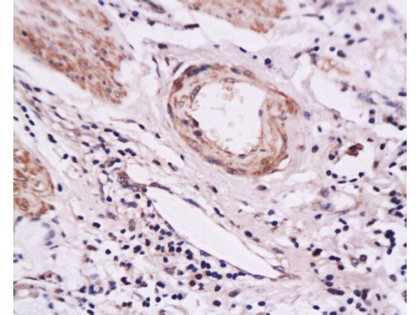 E-Selectin/CD62E Antibody in Immunohistochemistry (Paraffin) (IHC (P))