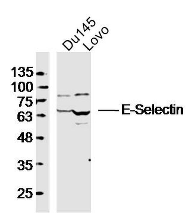 E-Selectin/CD62E Antibody in Western Blot (WB)