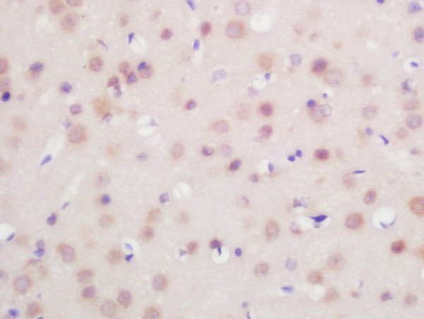 FoxP1 Antibody in Immunohistochemistry (Paraffin) (IHC (P))