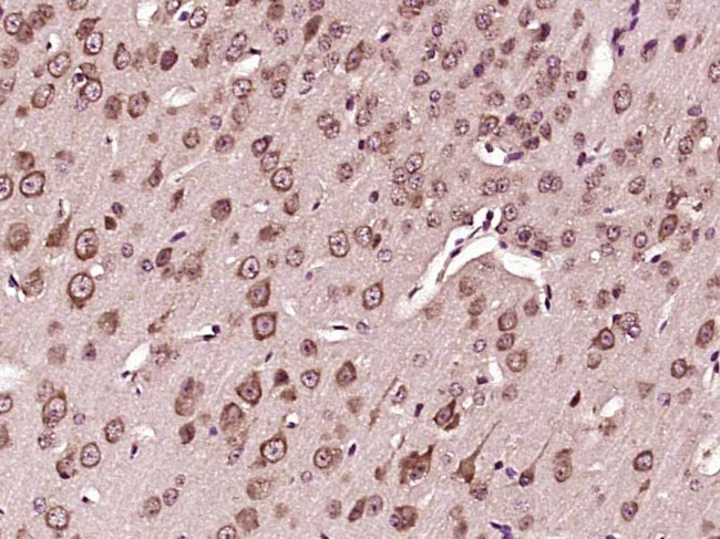 VPS33B Antibody in Immunohistochemistry (Paraffin) (IHC (P))