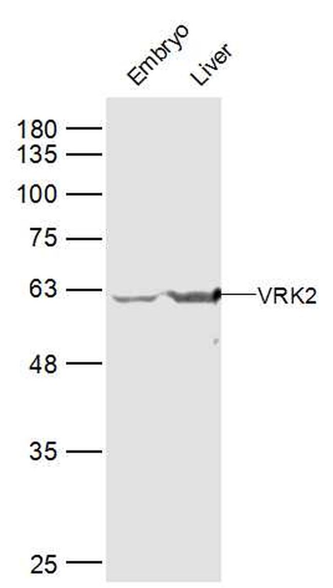 VRK2 Antibody in Western Blot (WB)