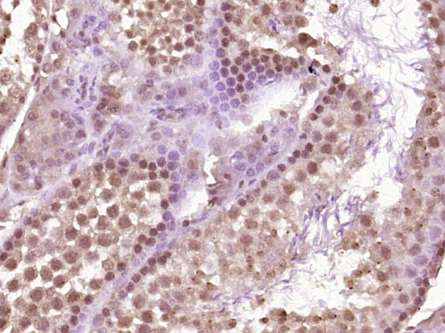 VRTN Antibody in Immunohistochemistry (Paraffin) (IHC (P))