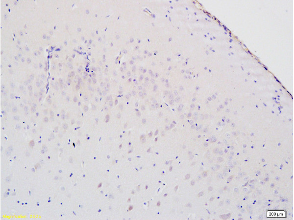 8-OHdG/8 Hydroxyguanosine Antibody in Immunohistochemistry (Paraffin) (IHC (P))