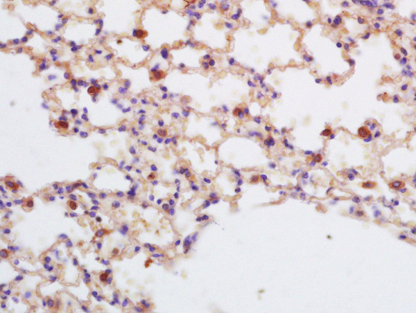 ASPP2/p53BP2 Antibody in Immunohistochemistry (Paraffin) (IHC (P))