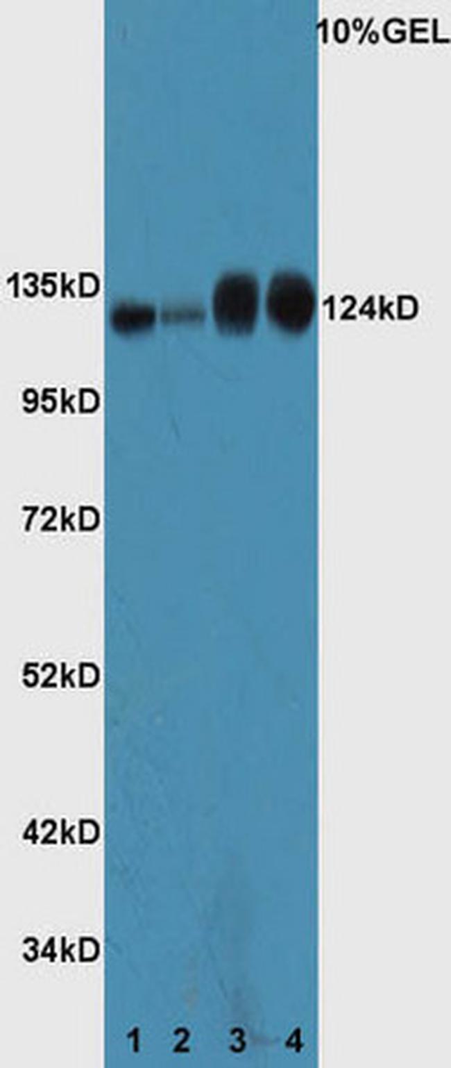 ASPP2/p53BP2 Antibody in Western Blot (WB)