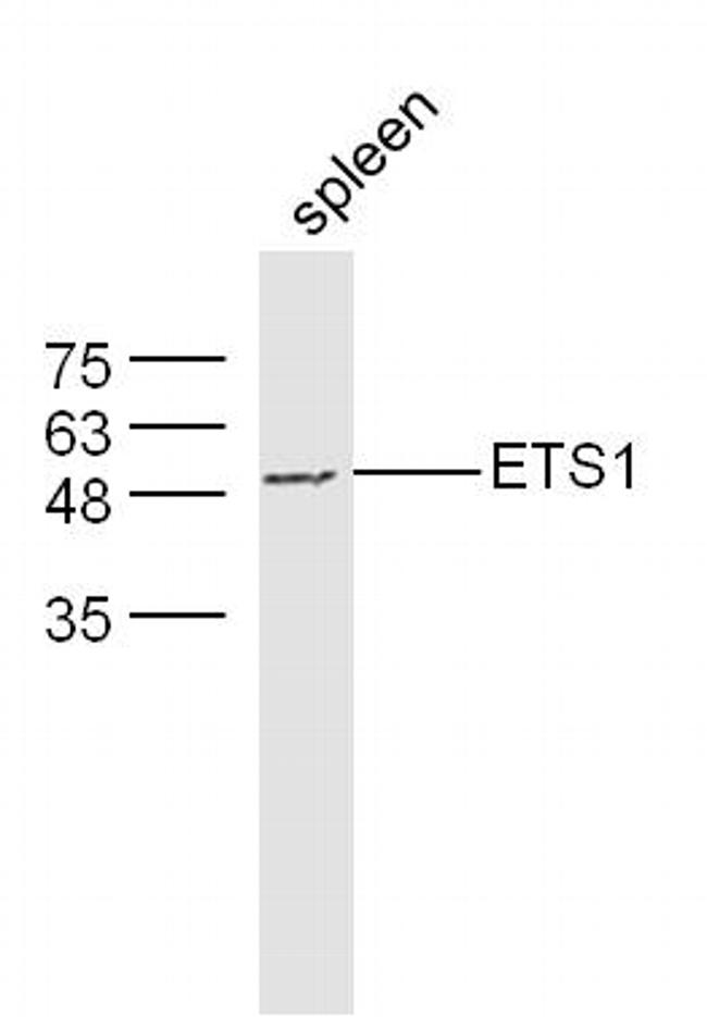 ETS1 Antibody in Western Blot (WB)