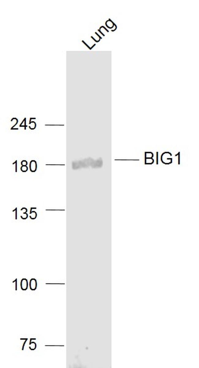 BIG1/ARFGEF1 Antibody in Western Blot (WB)