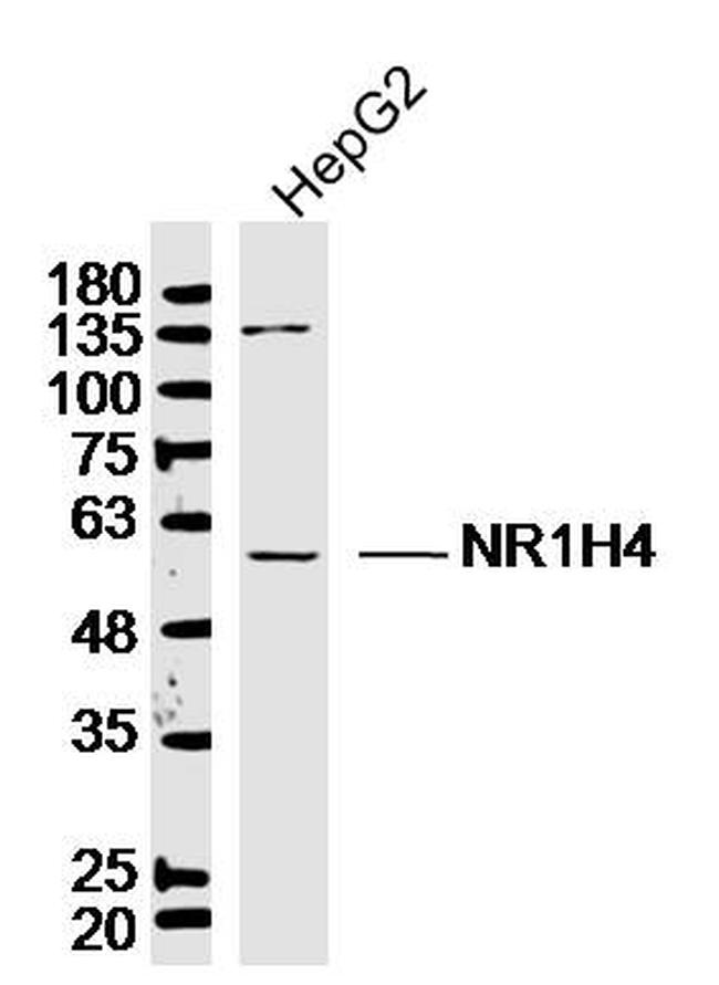 Bile Acid Receptor NR1H4 Antibody in Western Blot (WB)