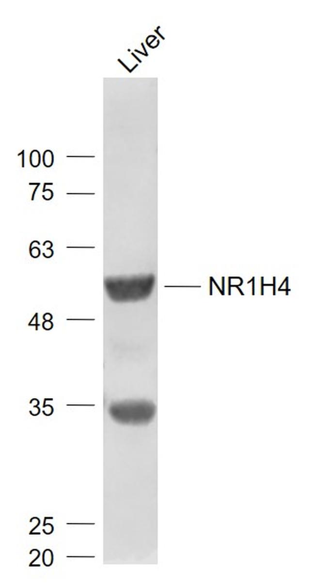 Bile Acid Receptor NR1H4 Antibody in Western Blot (WB)