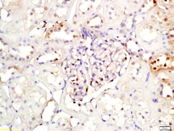 NFKBIA/IKB alpha Antibody in Immunohistochemistry (Paraffin) (IHC (P))