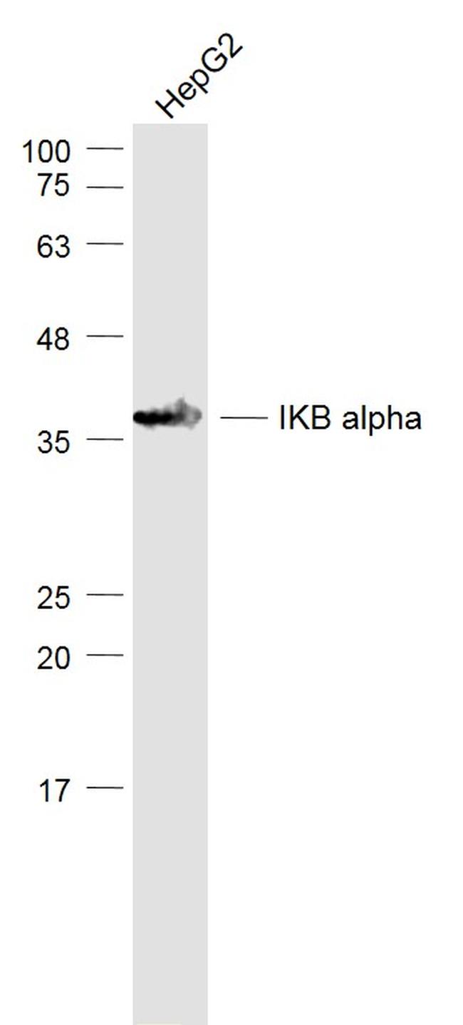 NFKBIA/IKB alpha Antibody in Western Blot (WB)