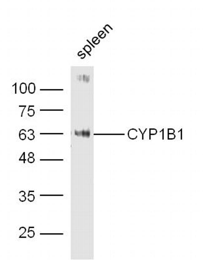 CYP1B1 Antibody in Western Blot (WB)