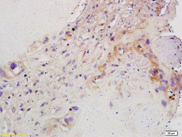 Aromatase Antibody in Immunohistochemistry (Paraffin) (IHC (P))