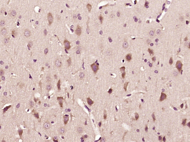 GABA B Receptor 2 Antibody in Immunohistochemistry (Paraffin) (IHC (P))